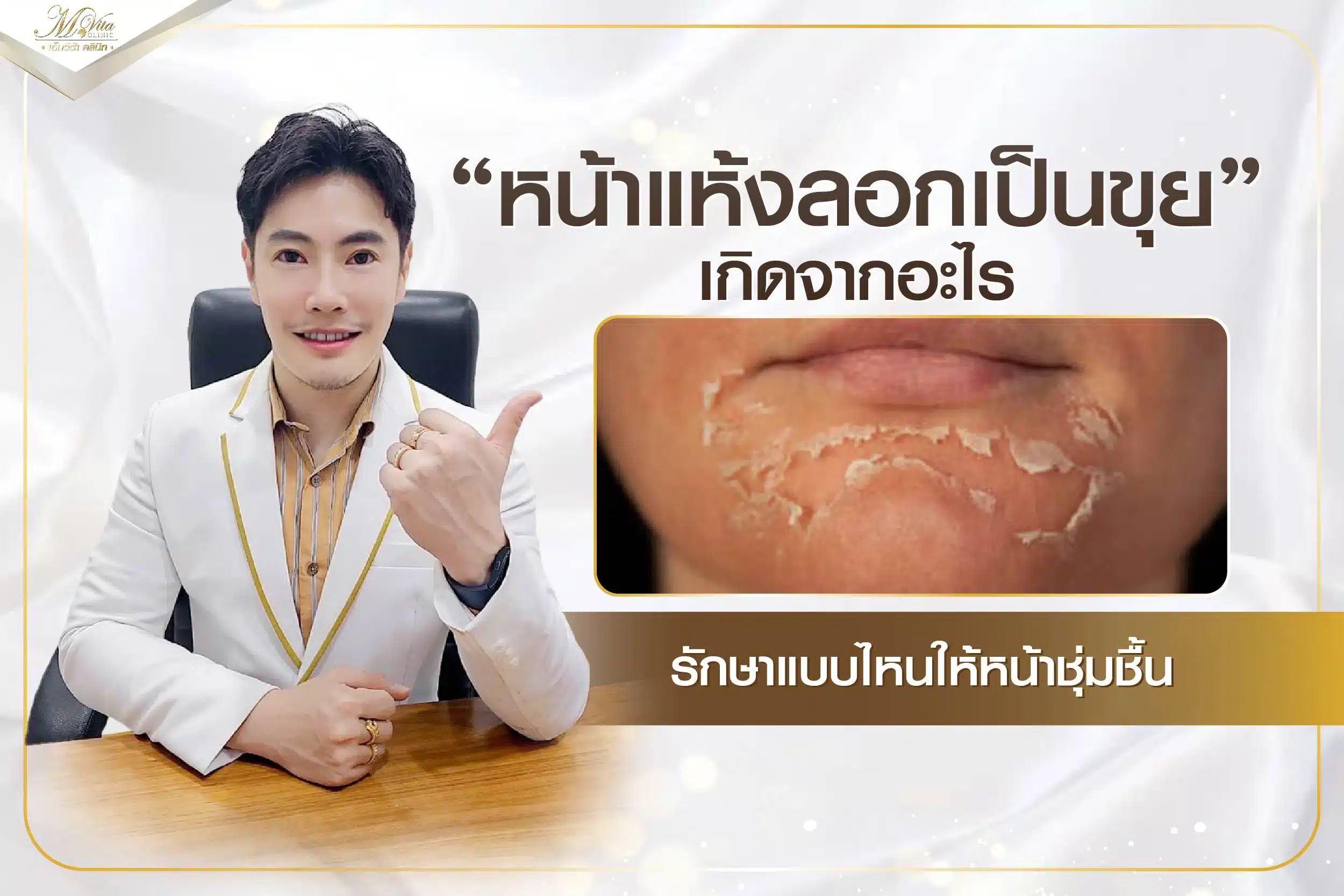 หน้าแห้งลอกเป็นขุยเกิดจากอะไร รักษาแบบไหนให้หน้าชุ่มชื้น