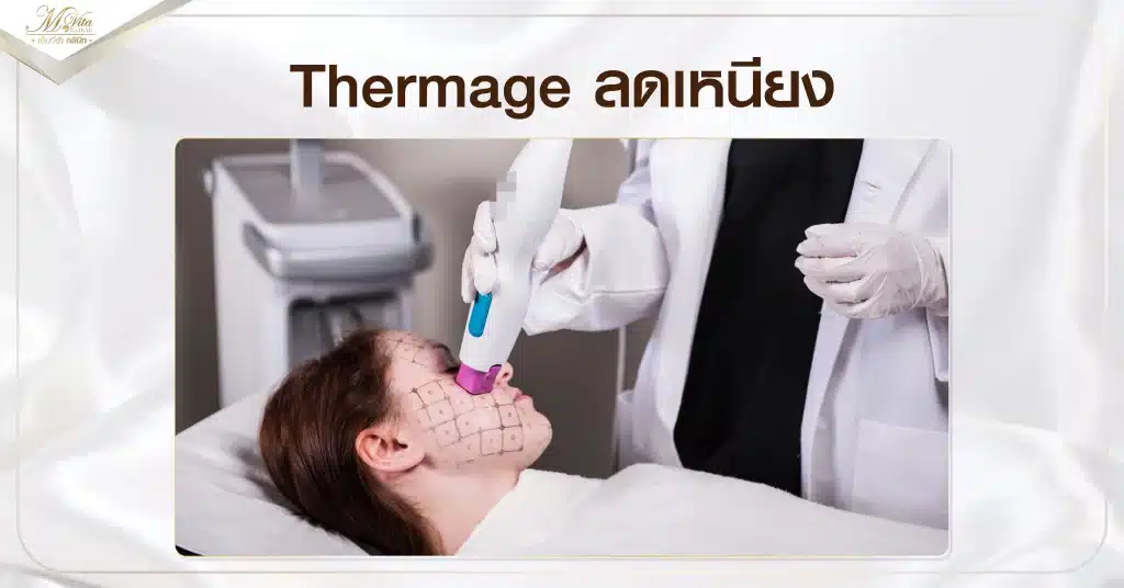 Thermage ลดเหนียง