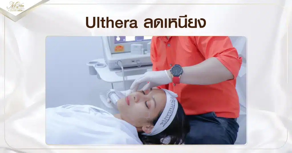 Ulthera ลดเหนียง