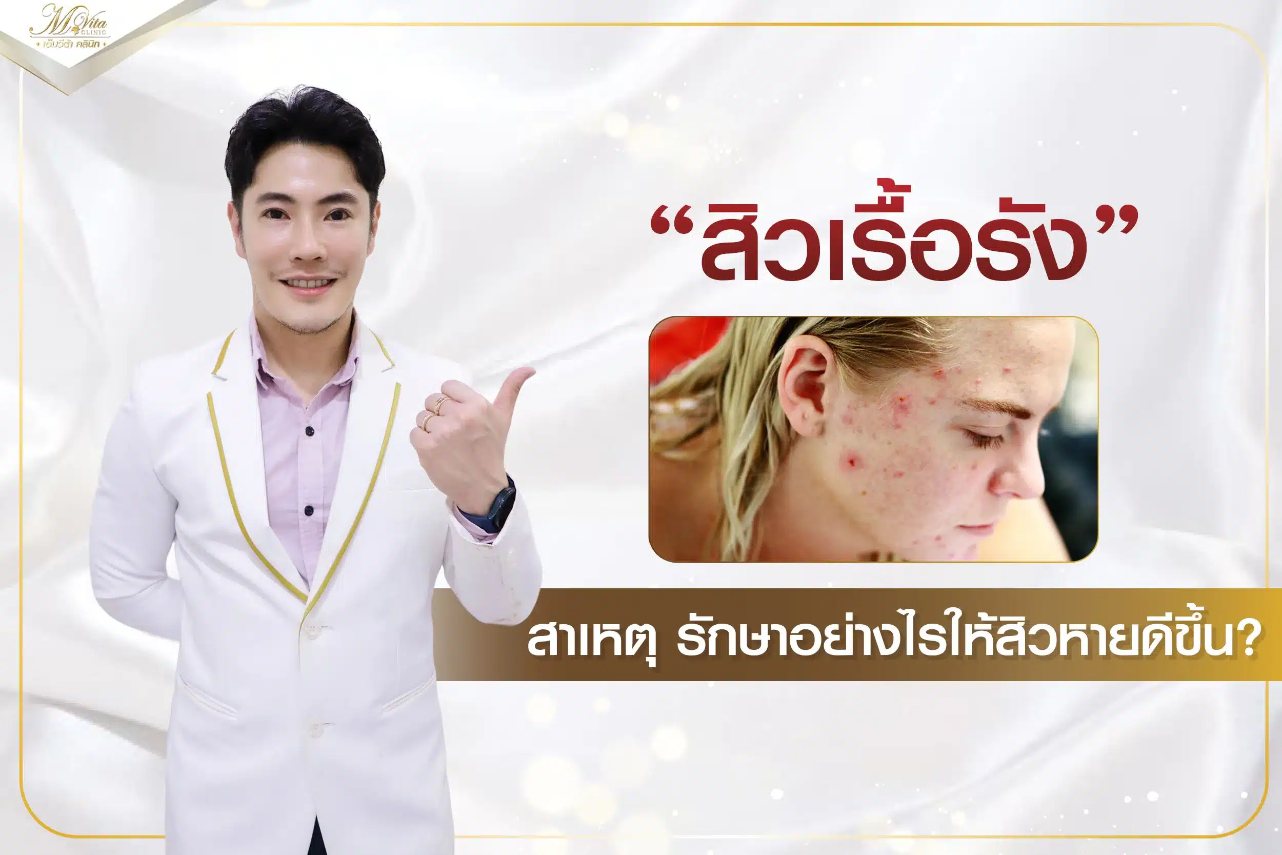 สิวเรื้อรังไม่หายสักที ทำยังไงดี?